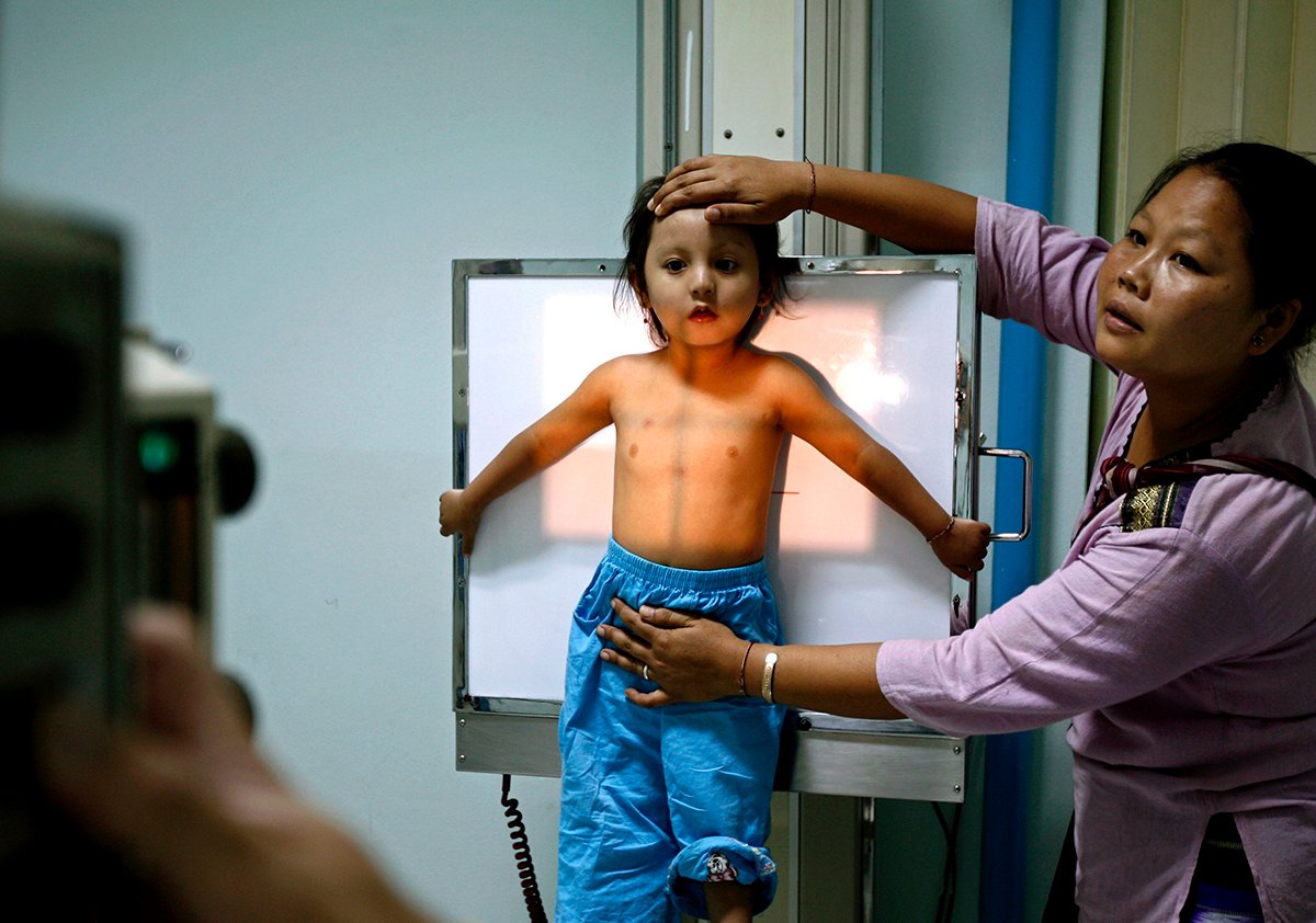 Обследование ребенка на туберкулез в больнице Паво в Мае Сот, Таиланд. Фото: Rungroj Yongrit / EPA